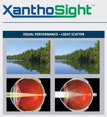 XanthoSight is a patented mixture of Lutein, Zeaxanthin, and Meso-Zeaxanthin supports eye health