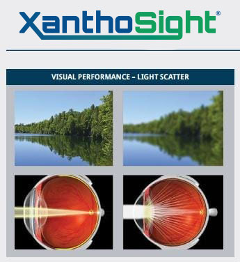 XanthoSight-B XanthoSight visual performance example